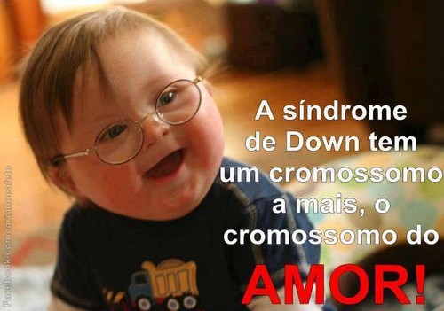 Sindrome de down