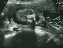 2013-05-20_ecografia Morfologica 19 semanas_1.jpg